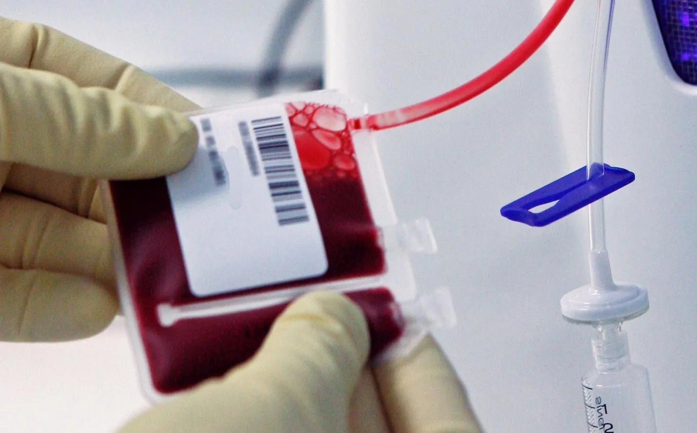 【最新研究】​臍帶血的儲存期限