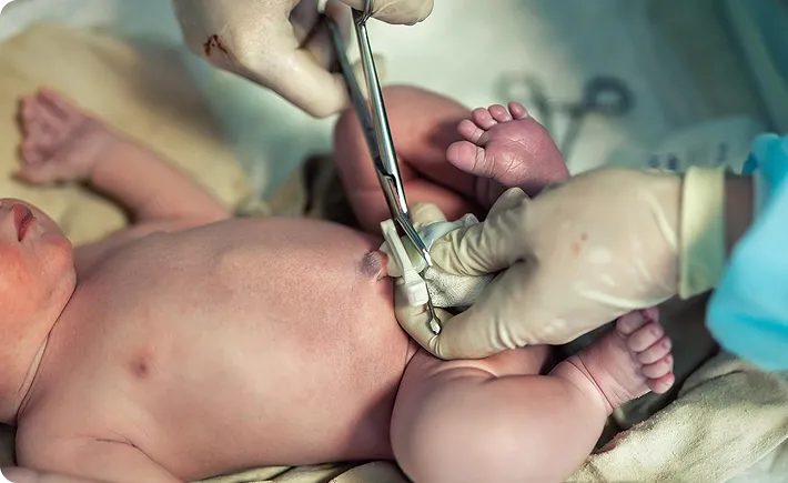 Delayed Cord Clamping & Banking